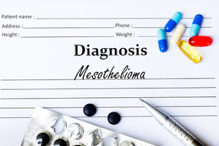 Mesothelioma-causes-Symptoms-Treatment 