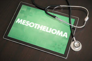 Mesothelioma-causes-Symptoms-Treatment 