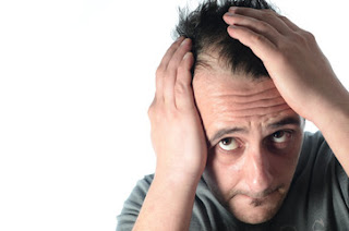 Causes-Symptoms-Types-Hair-Loss